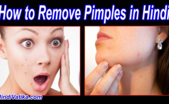 How to Remove Pimples in Hindi